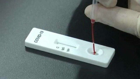Bursa’da bütün takım Corona test kiti bekliyor…